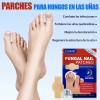 Parches Para Uñas Fúngicos 63pzs Caja De Parches Dañadas