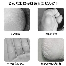 BIUTEFOR Heel Sharpener, Heel Care, Exfoliating Feet, Remove Dead Skin, Remove Cocoons, 6 in 1 Heel File Set