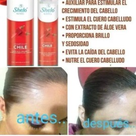 2 Shampoo Jitomate 530ml Acondicionador Chile Shelo Nabel                                                                                             