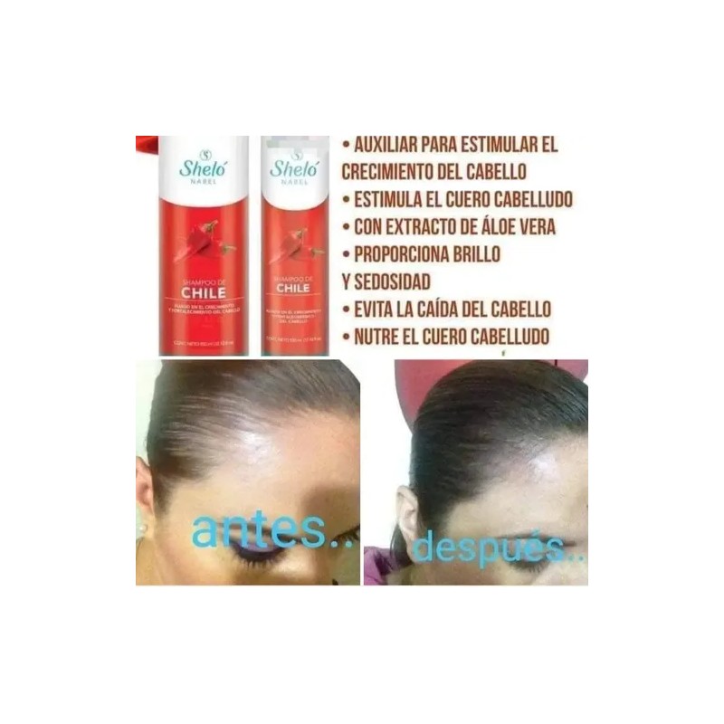 2 Shampoo Jitomate 530ml Acondicionador Chile Shelo Nabel