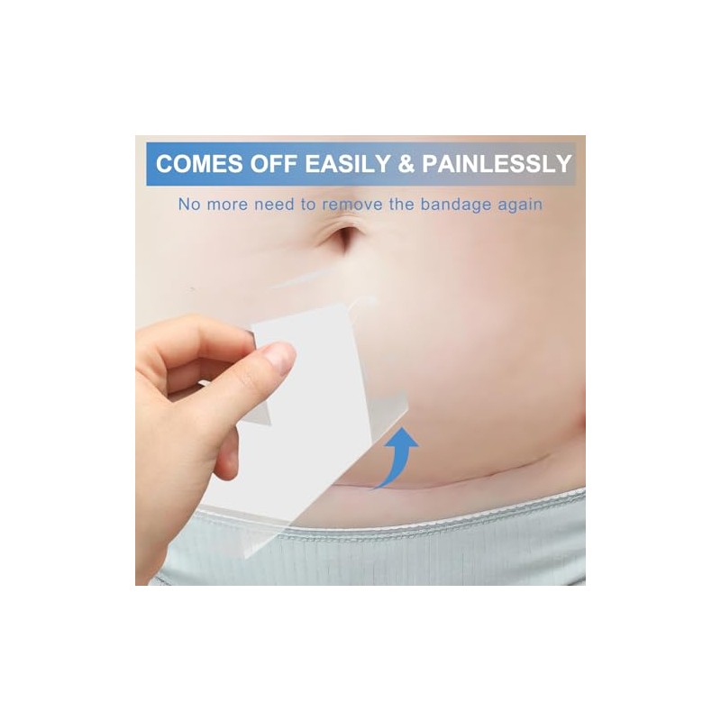 30 Pack Waterproof Adhesive Island Dressings for Surgery Recovery