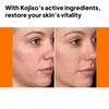 pH Lab Kojiso Skin Serum, Even Skin Tone (Pack of
