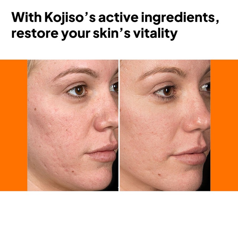 pH Lab Kojiso Skin Serum, Even Skin Tone (Pack of