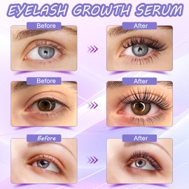 Premium Eyelash Growth Serum and Eyebrow Enhancer by Aomock, Lash Serum - 5ml,Lash Boost Serum for Longer, Fuller, Thicker Lashes & Brows…