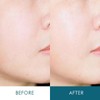 Anacis 아트박스/아나시스 리더미스 리싱크 악건성 속건조 히알루론산 앰플 55ml ArtBox/Anasis