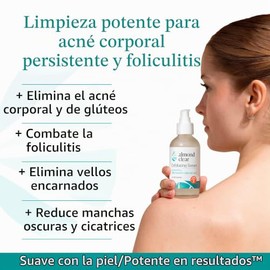 Body Clearing Serum Level 2 - Advanced formula for severe body acne, folliculitis- back, butt, chest, thighs, shoulders - mandelic acid - naturally...