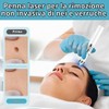 Tomedeks 1 Pezzo Penna per Acne a luce Blu, Penna