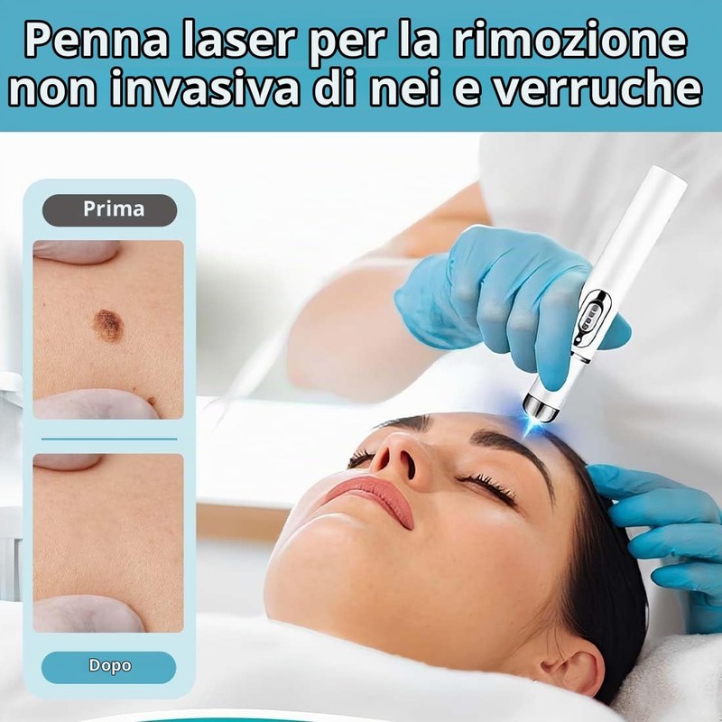 Tomedeks 1 Pezzo Penna per Acne a luce Blu, Penna