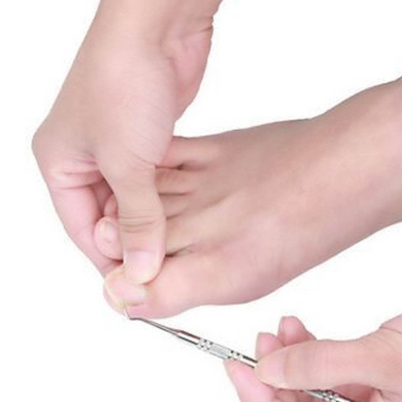 6 in 1 set Ingrown Toe Nail Fixer Pedicure Toenail