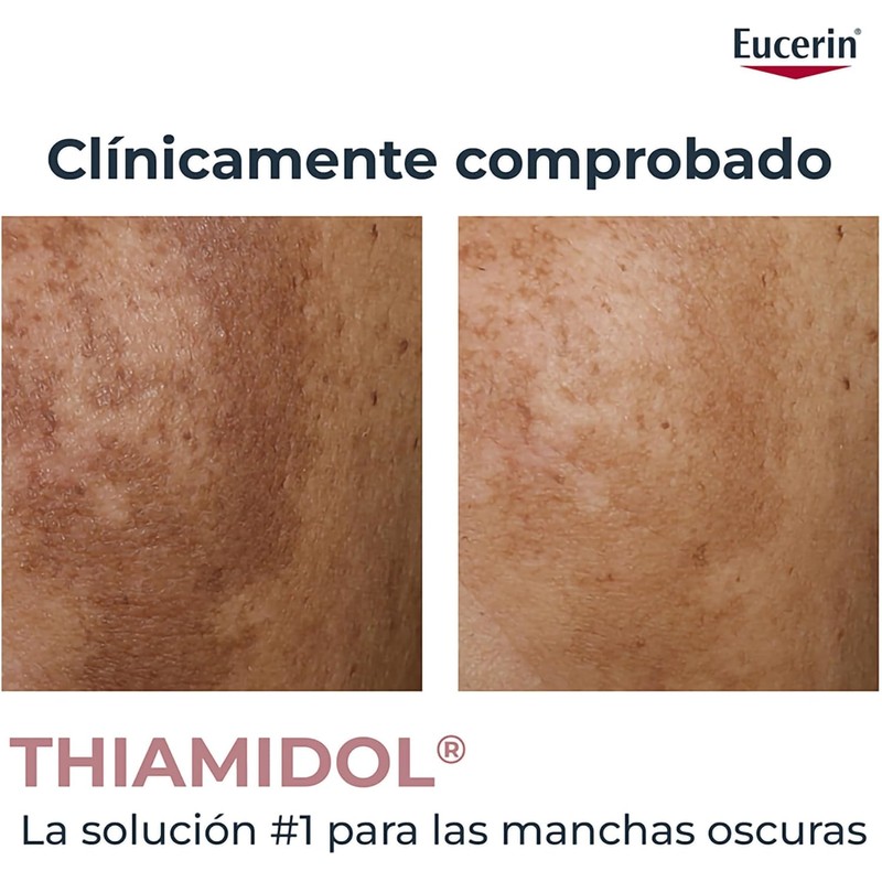EUCERIN Anti-Pigment Crema Corporal para Áreas Específicas (200ml) Ayuda a