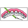 IDontix Brace X-Floss, Green