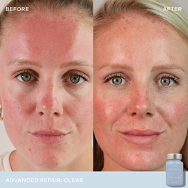 Vida Glow Clear Advanced Repair - 30 capsules 3 Pack