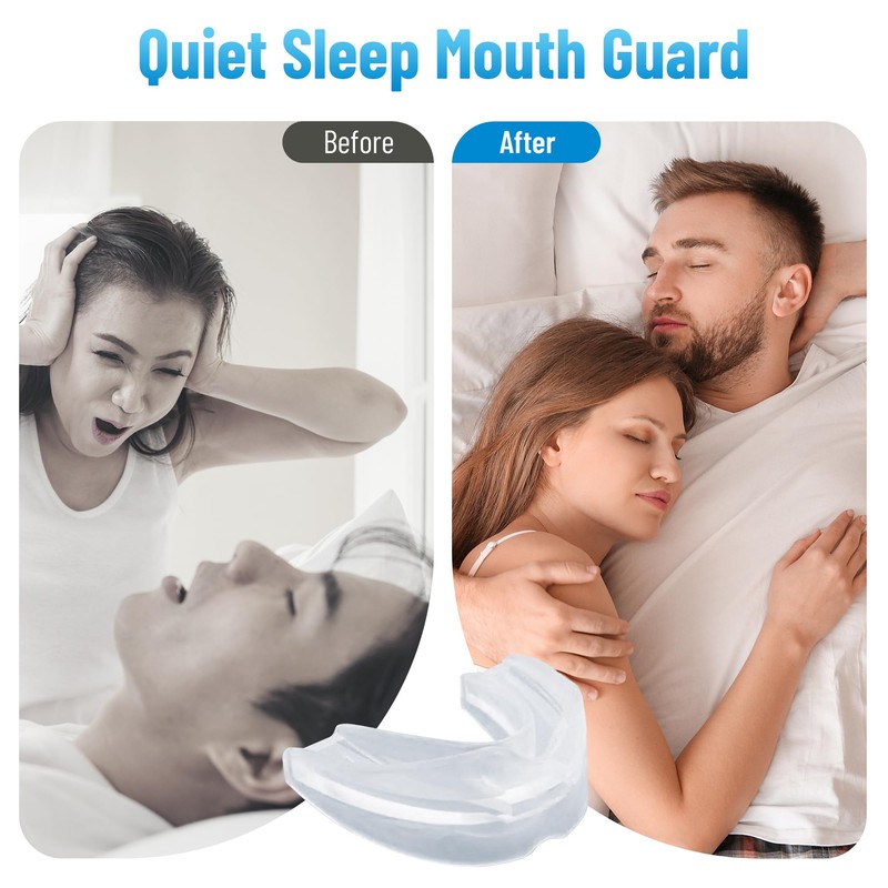Chic Derma Comfortable Sleep Mouth Guard – Custom Fit Nighttime