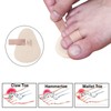 Mcvcoyh Adjustable 2 Loops Toe Splint, Hammer Toe Straightener with