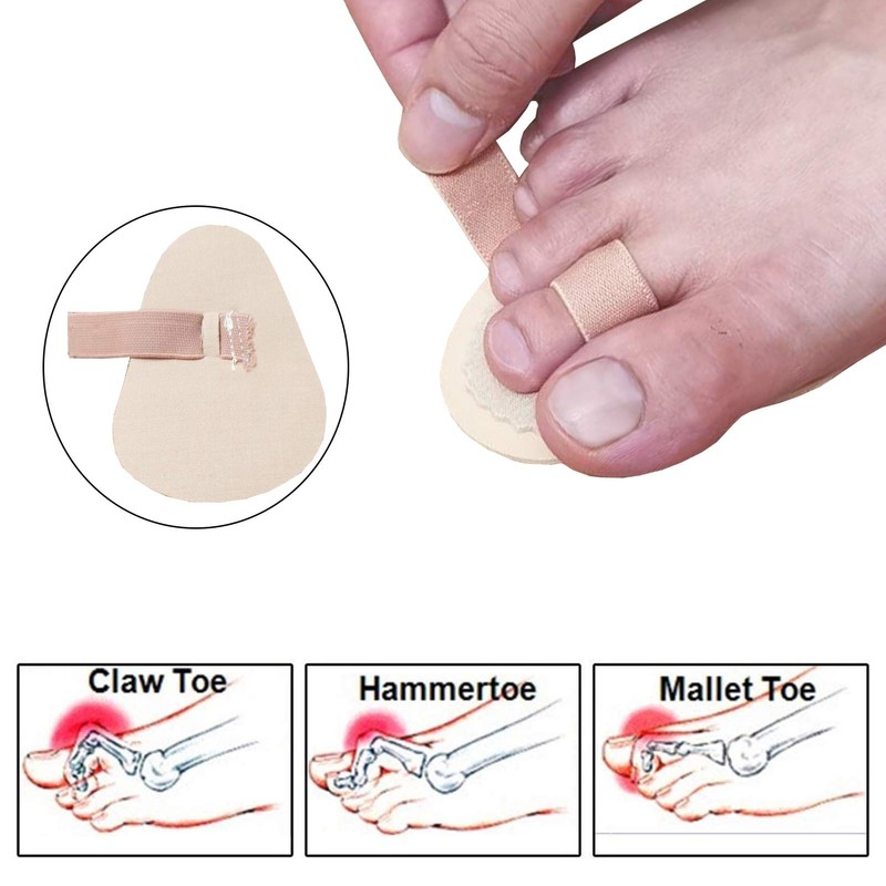 Mcvcoyh Adjustable 2 Loops Toe Splint, Hammer Toe Straightener with