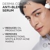 L'Oréal Men Expert Derma Control Anti-Blemish Serum, Smooth & Hydrated