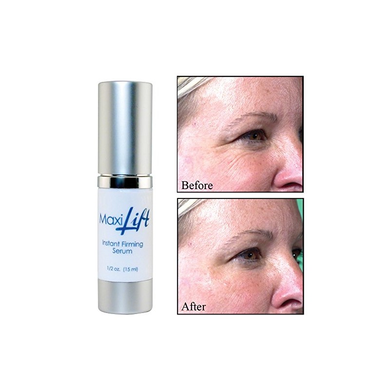 BioLogic Solutions MaxiLift Serum, Instant Face Lift Cream, Skin Tightening