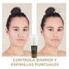 Crema Anti Acné, Control De Grasa, Reduce Manchas. Mc Life