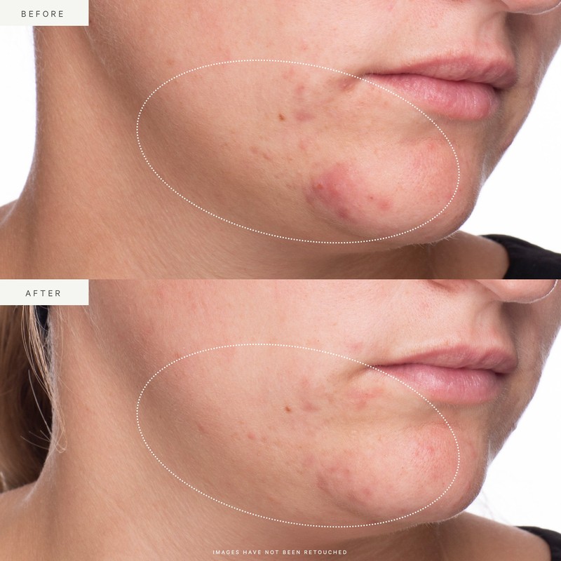 KORA Organics Active Algae Lightweight Moisturiser - 50ml