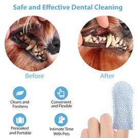 [Upgraded] Kopmath Dog Teeth Cleaning Finger Wipes, Tartar & Plaque Remover with Brushing Beads, More Friction, Dog Breath Freshener, Natural Dog Dental Wipes for Cat, Disposable Dog Teeth Wipes, Mint