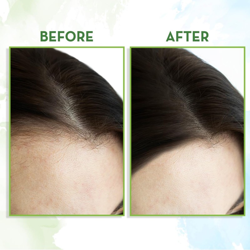 Mamaearth Rosemary Essential Oil for Hairs - 15 ml |