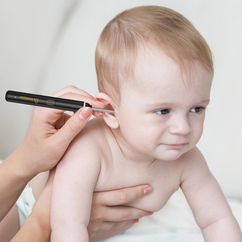 VITCOCO HD Ear Scope with Camera - 1920P WiFi Otoscope