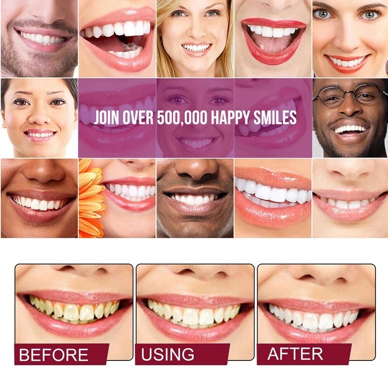 SP-6 Ultra Brightening Probiotics Toothpaste - 120g Sensitive Teeth Whitening