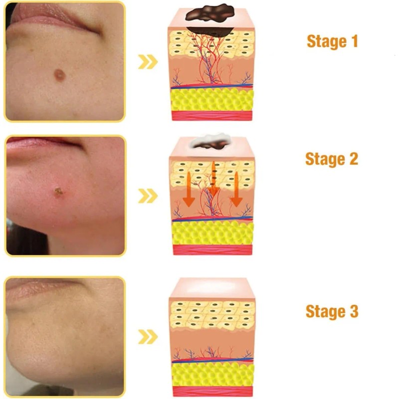 3 Unidades, Limpia Y Cuida Suavemente La Piel, Crema Para