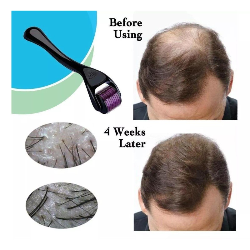 Didier Market Dermaroller Facial Barba Produce Colágeno Elimina Arrugas