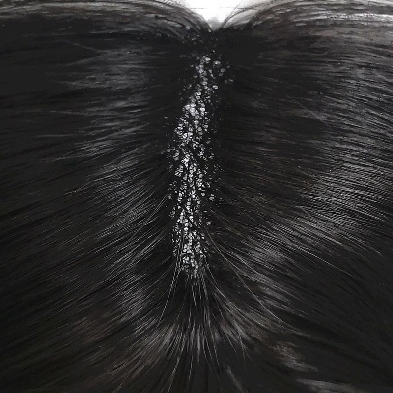 レディース手植え 広範囲 女性用部分ウィッグ 部分かつら 増毛用トップカバー 日常通勤 超リアル 脱毛症 薄毛 白髪隠し