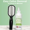 Dr. Entre's Callus Remover Gel & Foot File: Extra Strength