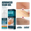 Crema Para Cicatrices En Gel Queloid Acne Removal Treatment,