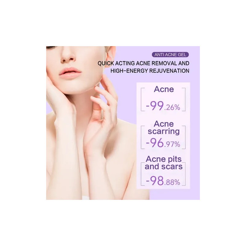 3pcs Gel Peróxido Benzoilo 10% Elimina Acné Puntos Negros