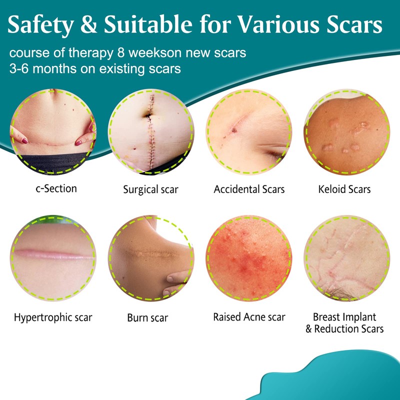 Silicone Scar Sheets,Professional Silicone Tape for Scars(16 pads-5.9”x 1.6”),Silicone Scar