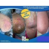 500gr Crema Mas Suave, Pomada Nopsor 125gr Aux. Tx Psoriasis