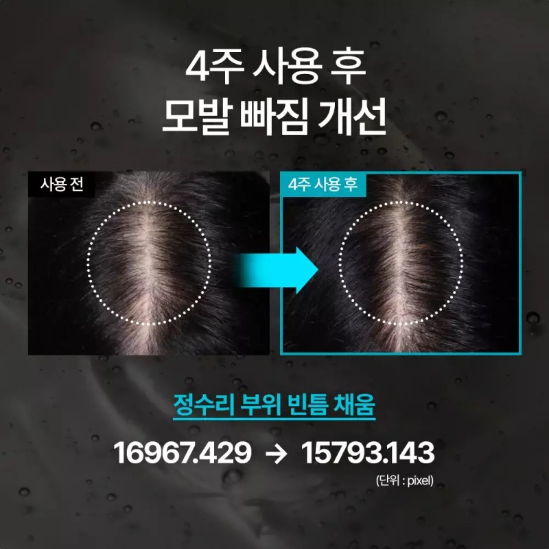 Blackbean 블랙빈 탈모증상개선 집중 앰플 Black Bean Hair Loss Improvement