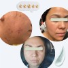Tratamiento Desmanchador Quita Mancha Trio Paño Acne Melasma