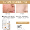 Turmeric Serum, Dark Spot Correcting Serum, Hyperpigmentation Treatment, Dark Spot