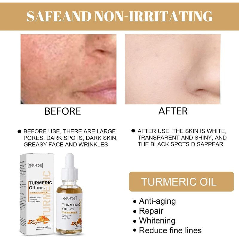 Turmeric Serum, Dark Spot Correcting Serum, Hyperpigmentation Treatment, Dark Spot