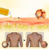ThermoFirm Bee Venom Gynecomastia Oil, 2026 New Chest Muscles Bee