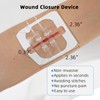 Emergency Wound Closure Devices, Zipper Wound Closure Strips, Laceration Closure