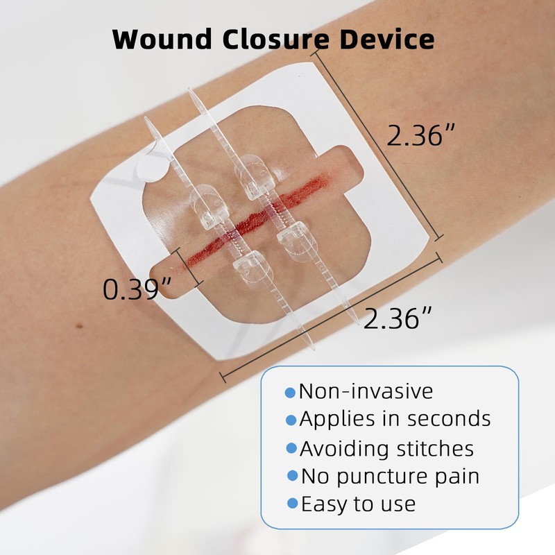 Emergency Wound Closure Devices, Zipper Wound Closure Strips, Laceration Closure