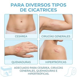 3M Parches de Silicona para Cicatrices y Acné, 4cm x 3m