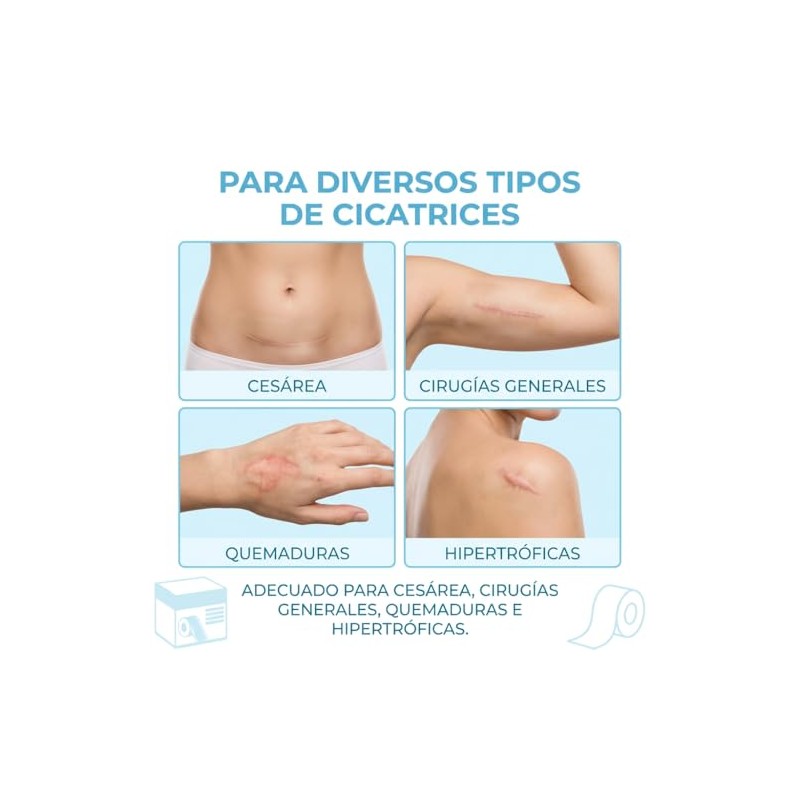 3M Parches de Silicona para Cicatrices y Acné, 4cm x