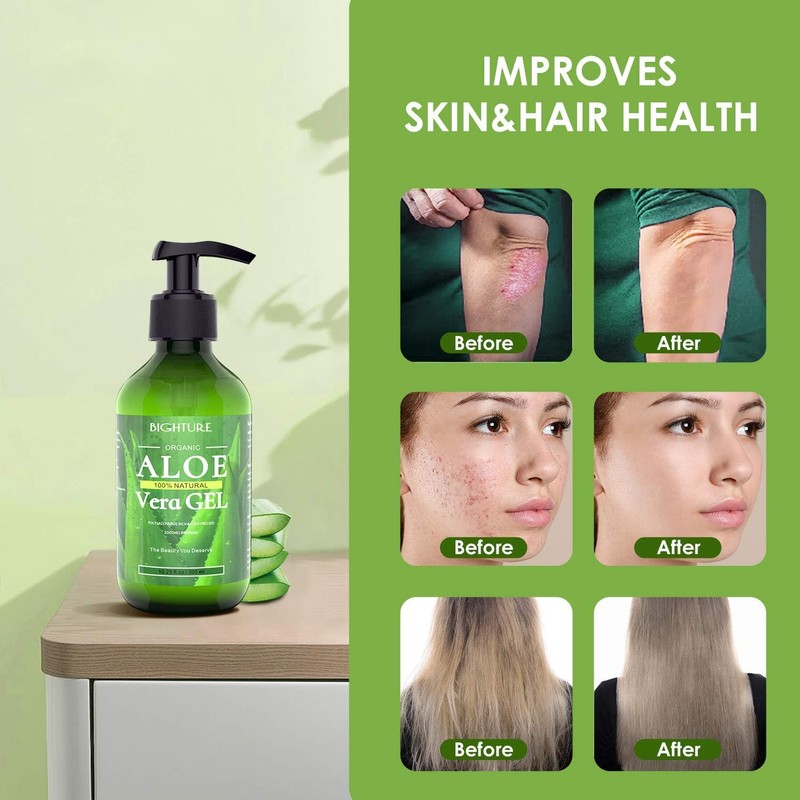Gel de aloe vera