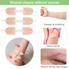 QZQUFJ 12 St1cke Wundnahtstreifen, Wundnahtstreifen Strips Klammerpflaster, Selbstklebende Bandagen, Notfall
