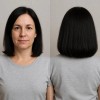 GS Hair Surgery Treatment for Black Hair /Cirugia Capilar para
