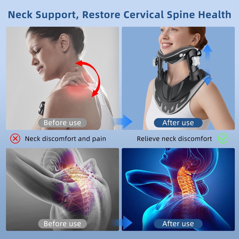 Neck Stretcher Cervical Traction, Adjustable Cervical Neck Traction Device, Neck