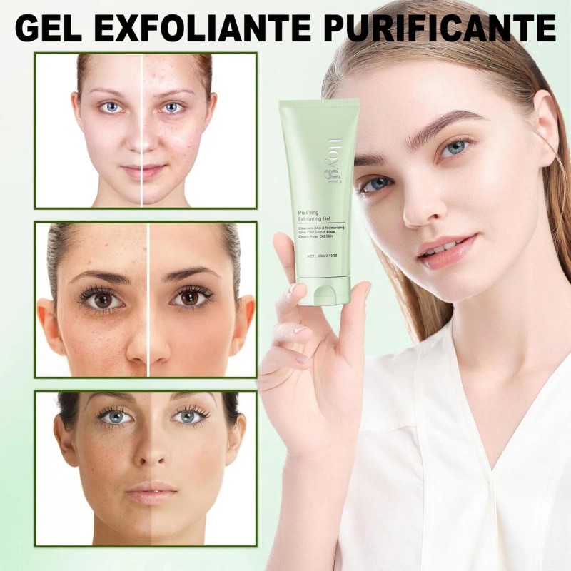 Gel Exfoliante Purificante Facial Eliminar Acné Cabeza Negra