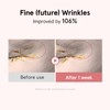 ONE THING PDRN Bakuchiol Serum, Daily Moisturizing Face Serum for